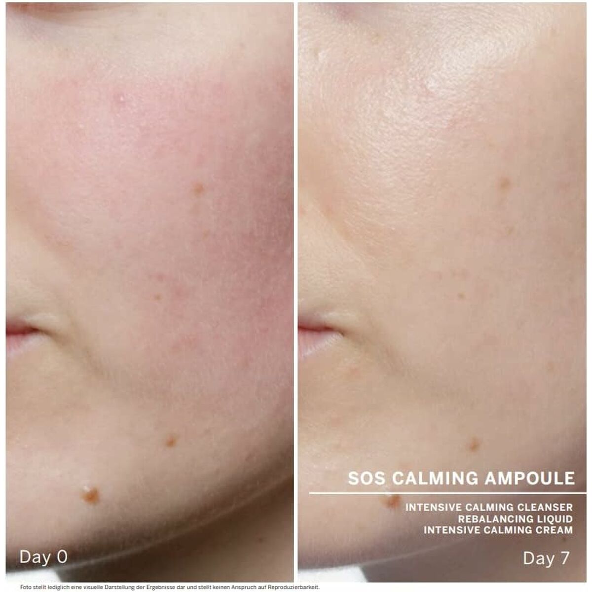 Traitement Facial Babor Sos Calming