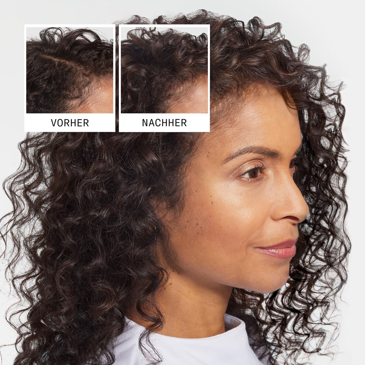 Shampooing antichute de cheveux Nioxin Anti-Hairloss 240 ml