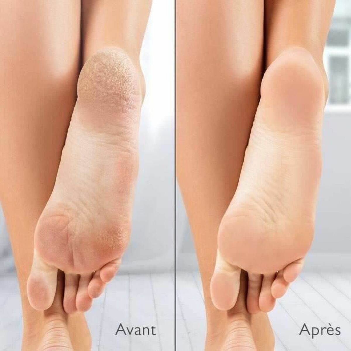 Éliminateur de Callosité Électrique Silk´n Vacupedi (5 Unités)