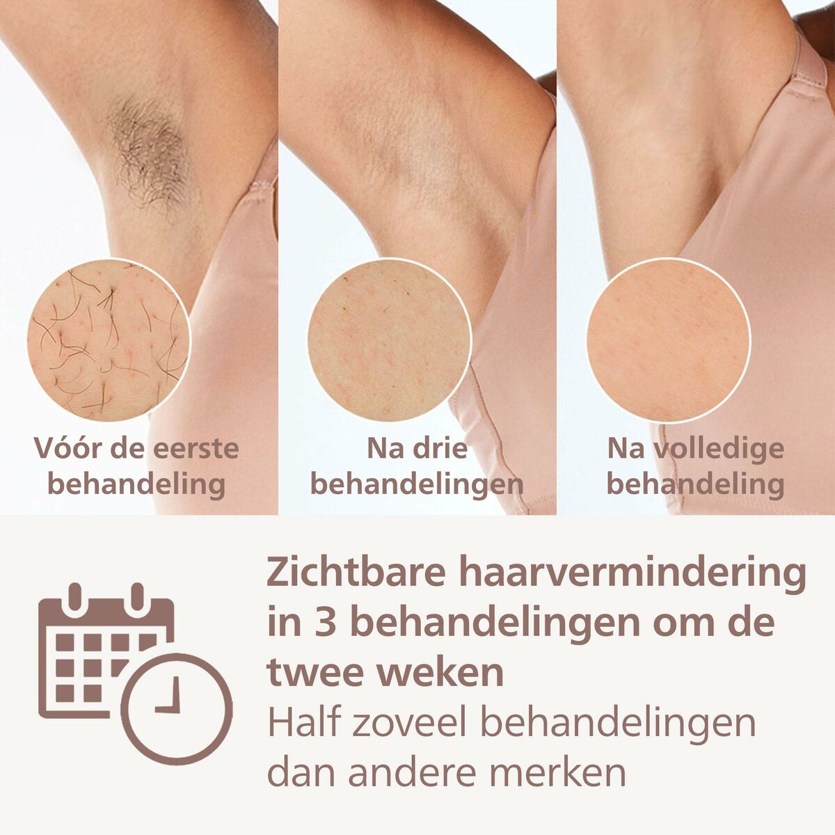 Épilateur à lumière pulsée Philips BRI946/00     *